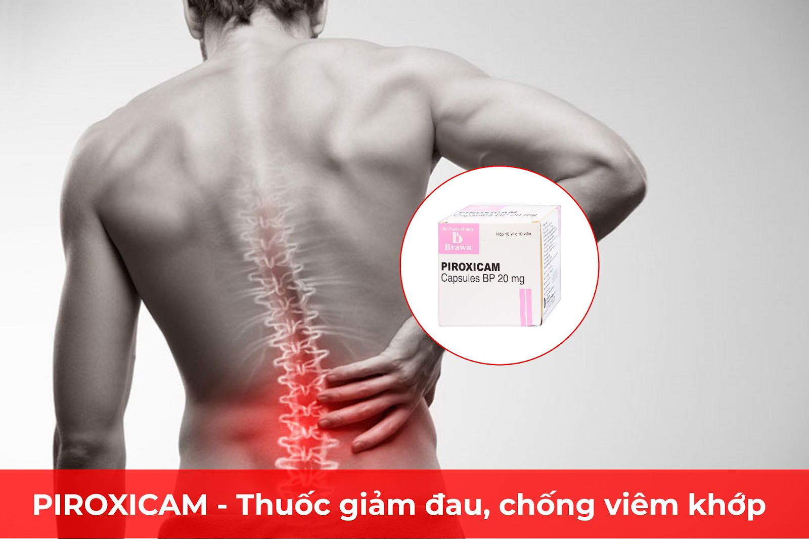 Piroxicam cải thiện đau lưng do bệnh lý cột sống hiệu quả